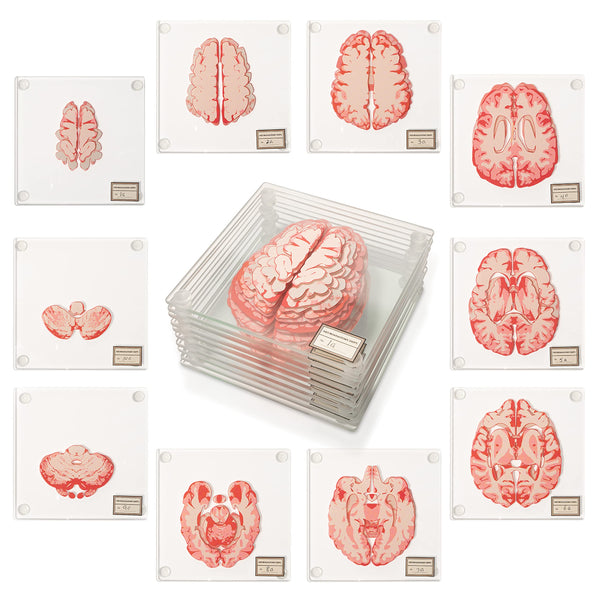 Anatomic Brain Specimen Coasters (Set of 10) - Neuroscience Gifts Best Gifts for Medical Student Gifts Brain Decor Human Anatomy Gifts Weird Gifts Thinkgeek Coasters think geek gifts 3D Brain Coasters